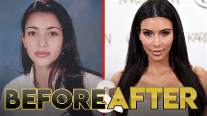 Kim Lim Before And After
