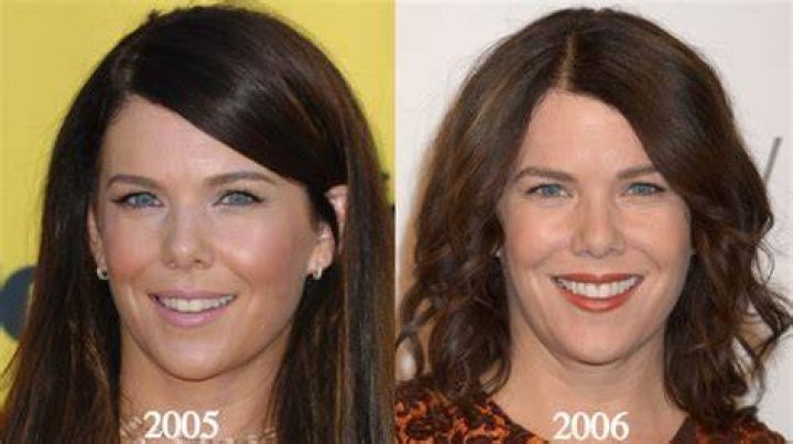 Lauren Graham plastic surgery