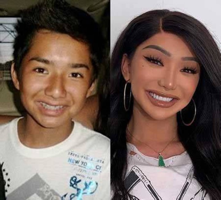 Nikita Dragun Bottom Surgery