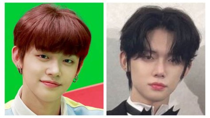 Yeonjun Plastic Surgery